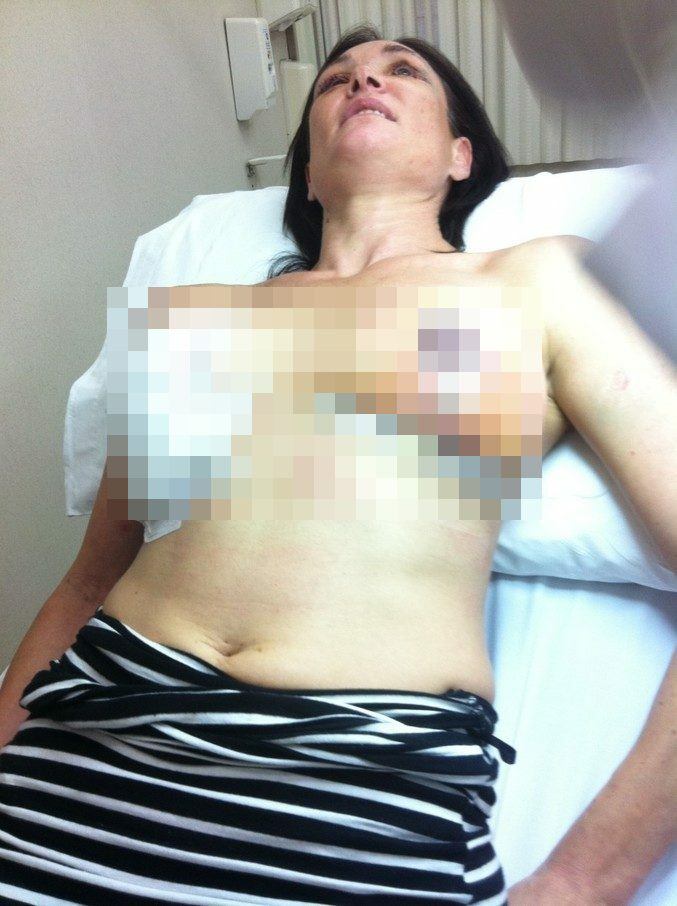 surgery6 blurred tmp